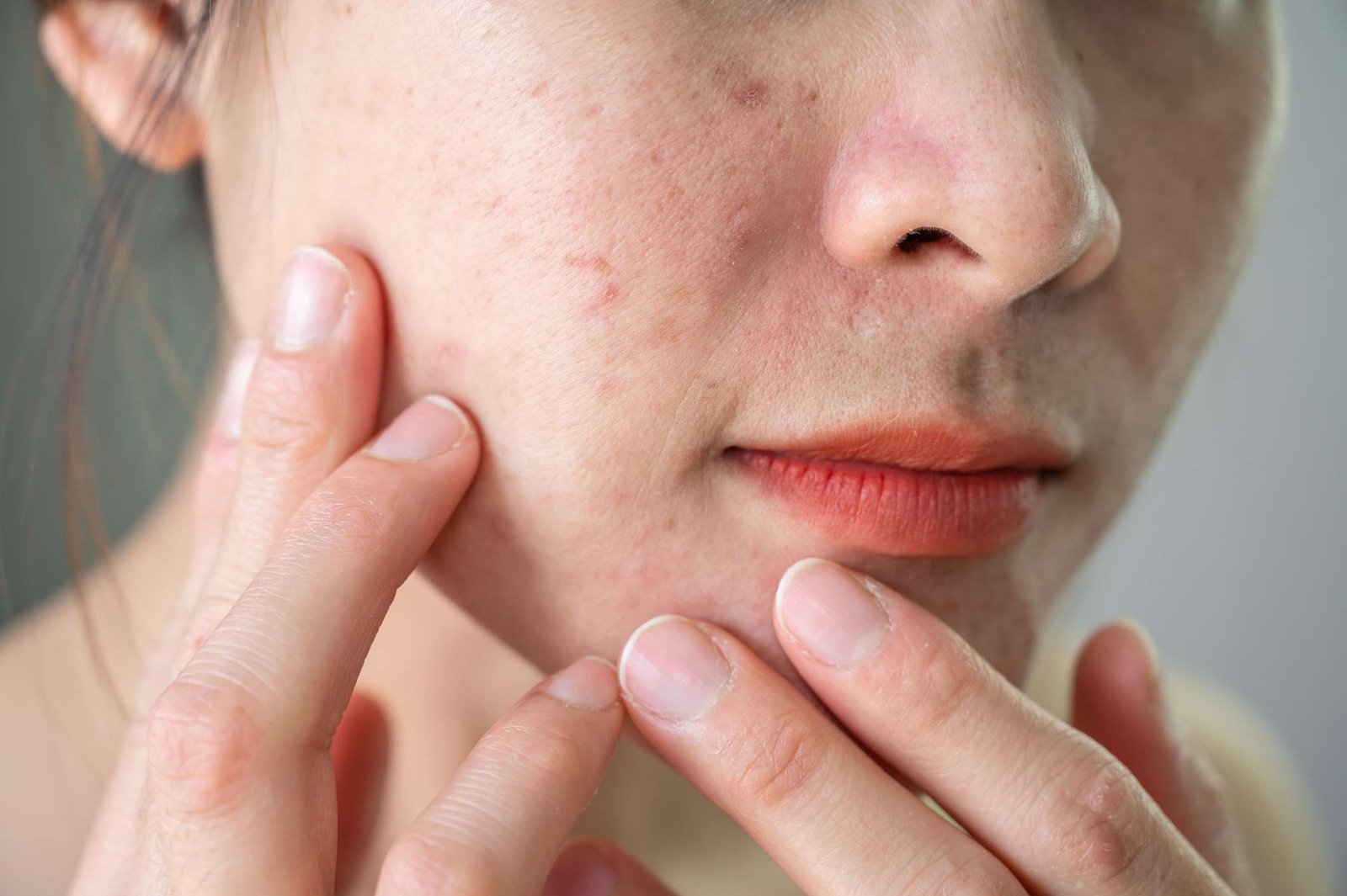 how to fix textured skin